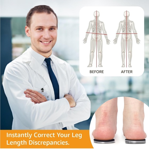 Adjustable Orthopedic Heel Lift Inserts for Heel Pain and Leg Length Discrepancy - Picture 2 of 6